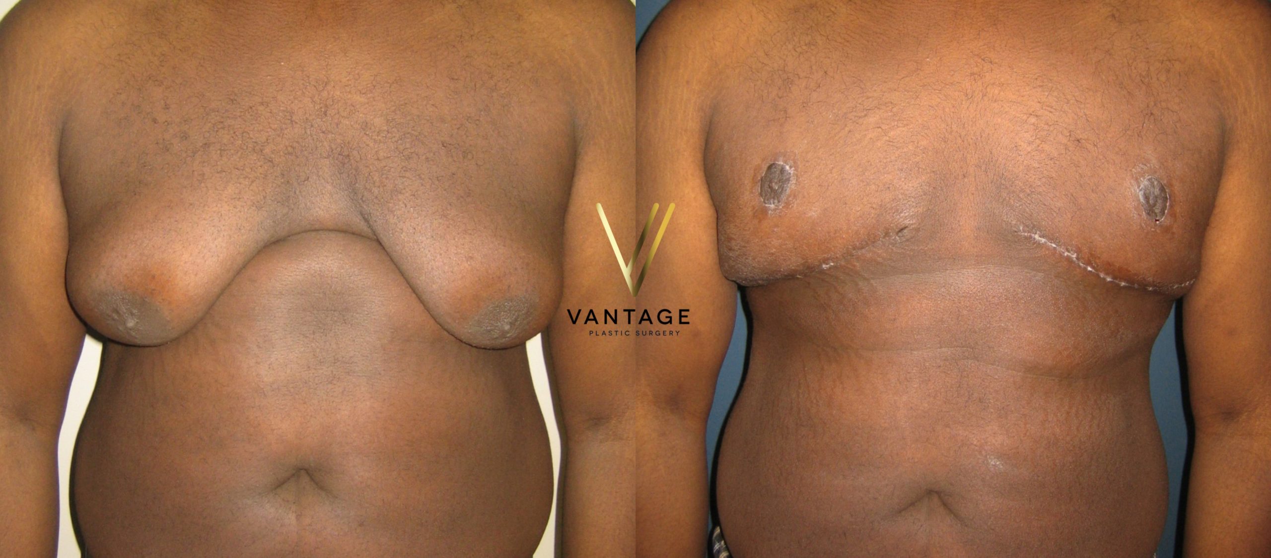 Photo Aug 23, 3 02 41 PM min